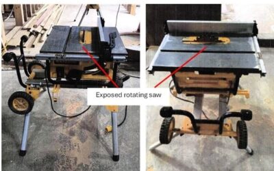 Apprentice joiner’s thumb re-attached
